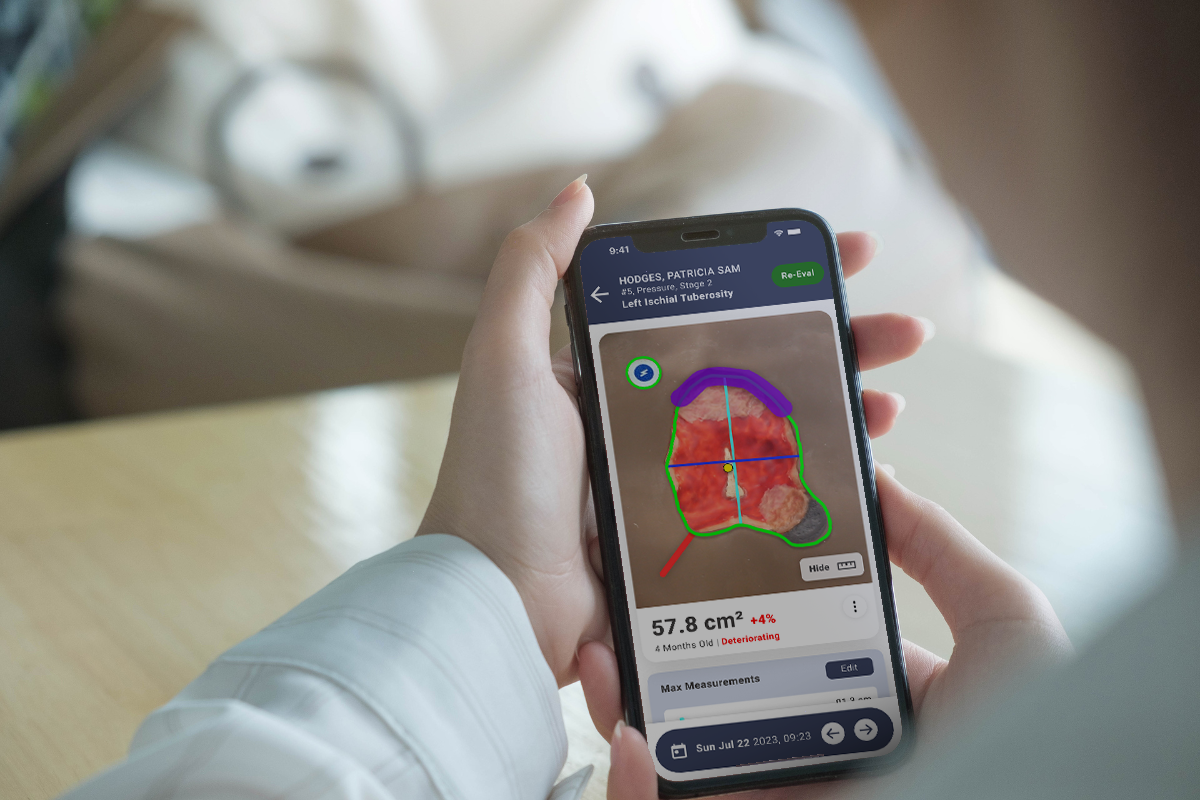 Camera in Clinicians Hands
