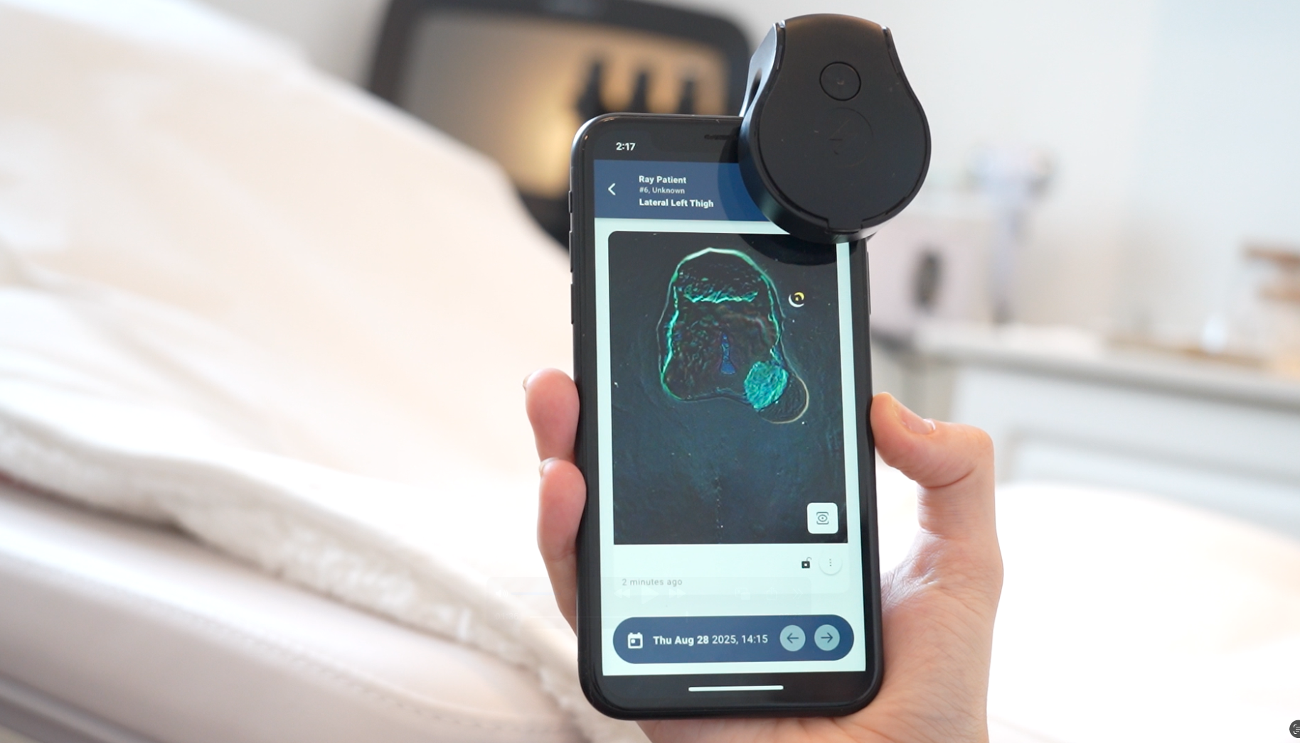 Swift Ray 1 Bacterial Imaging In-Hand with Background 2